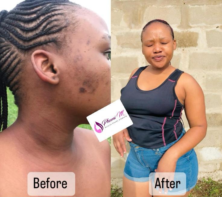 Face & neck routine — before & after