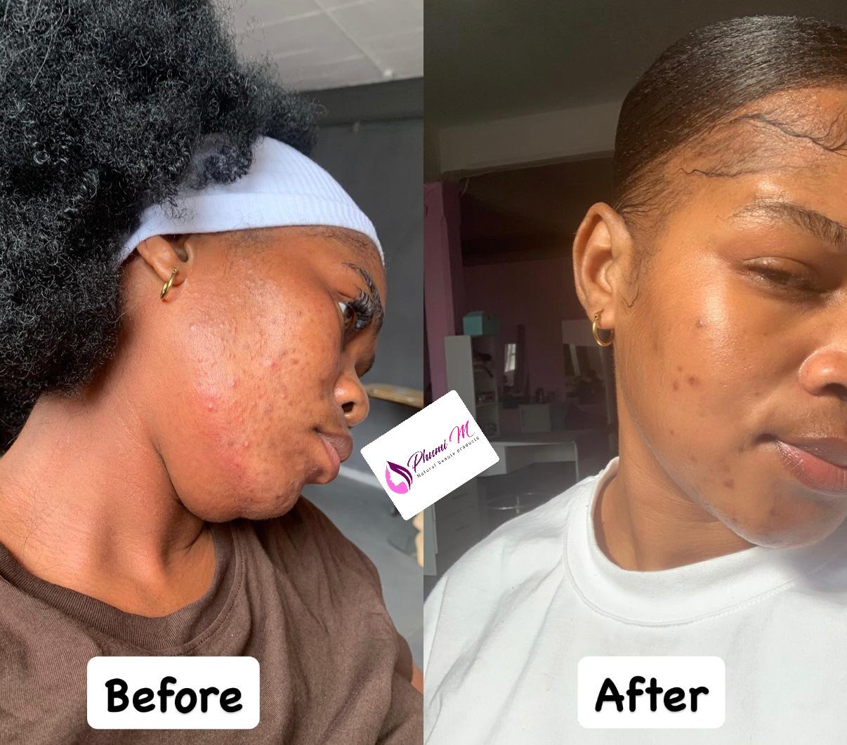 Face-care routine — smoother, clearer cheeks