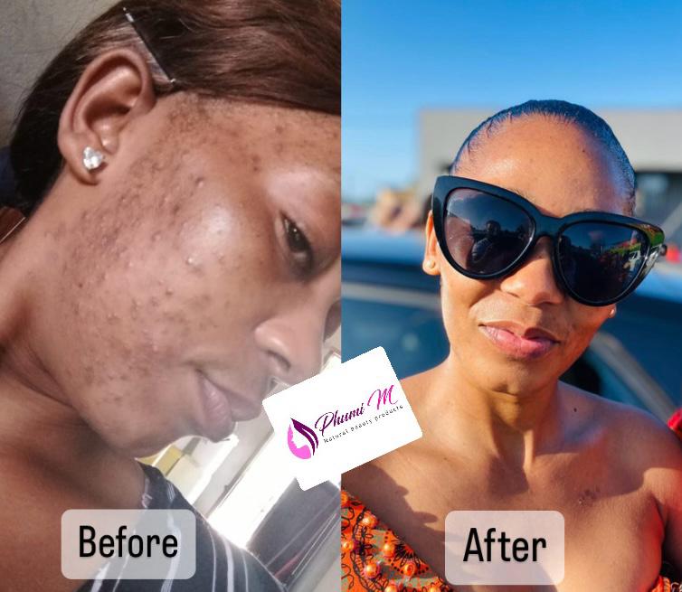 Face-care routine — even, glowing tone