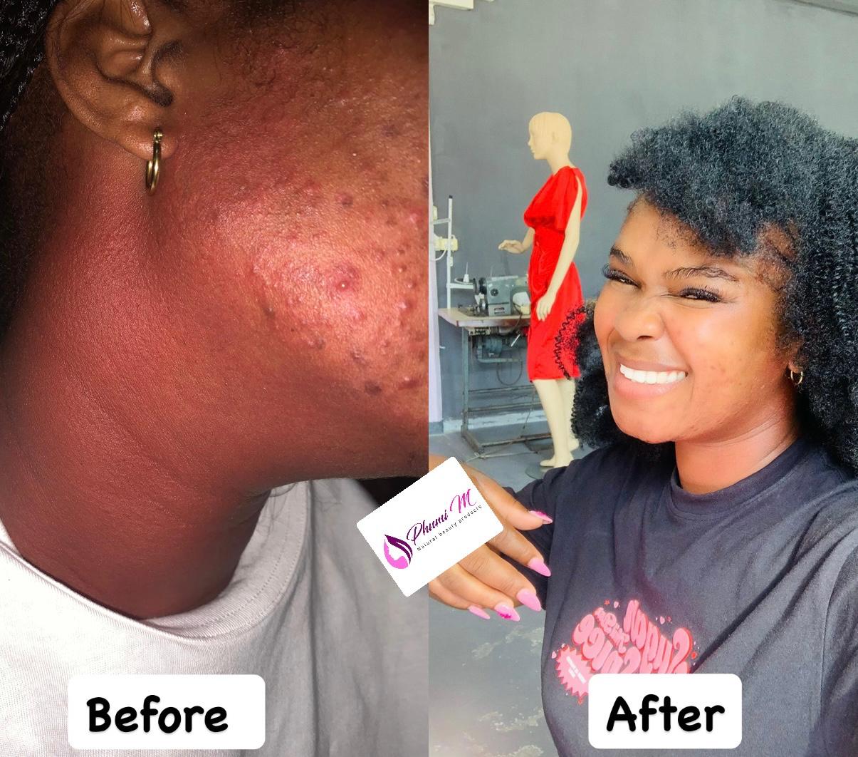 Face & neck routine — clearer, calmer skin